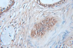 CAPG Rabbit anti-Human, Mouse, Rat, Polyclonal, Proteintech:Antibodies:Primary