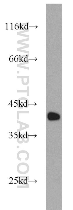 CAPG Rabbit anti-Human, Mouse, Rat, Polyclonal, Proteintech:Antibodies:Primary