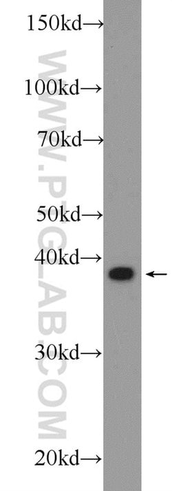 CAPG Rabbit anti-Human, Mouse, Rat, Polyclonal, Proteintech:Antibodies:Primary