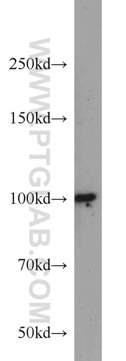 DDX23 Rabbit anti-Human, Mouse, Rat, Polyclonal, Proteintech:Antibodies:Primary