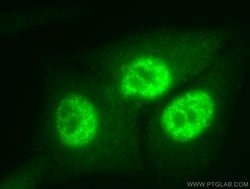 PCNA Rabbit anti-Human, Mouse, Rat, Zebrafish, Polyclonal, Proteintech