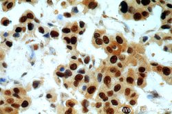 PCNA Rabbit anti-Human, Mouse, Rat, Zebrafish, Polyclonal, Proteintech