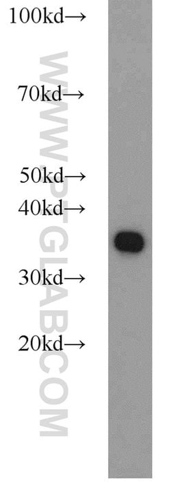 PCNA Rabbit anti-Human, Mouse, Rat, Zebrafish, Polyclonal, Proteintech