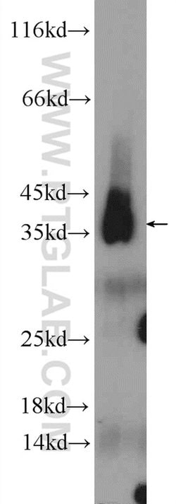 PCNA Rabbit anti-Human, Mouse, Rat, Zebrafish, Polyclonal, Proteintech