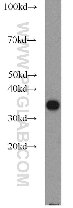 PCNA Rabbit anti-Human, Mouse, Rat, Zebrafish, Polyclonal, Proteintech