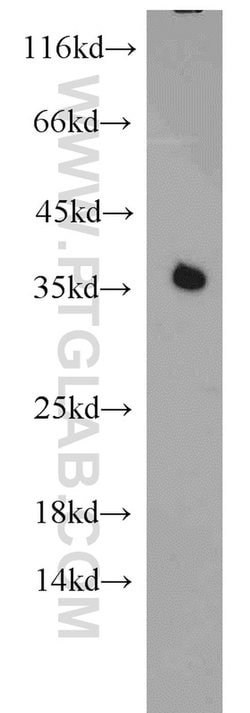 PCNA Rabbit anti-Human, Mouse, Rat, Zebrafish, Polyclonal, Proteintech