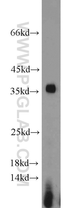 PCNA Rabbit anti-Human, Mouse, Rat, Zebrafish, Polyclonal, Proteintech