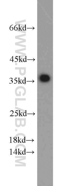 PCNA Rabbit anti-Human, Mouse, Rat, Zebrafish, Polyclonal, Proteintech