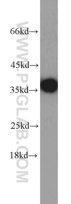 PCNA Rabbit anti-Human, Mouse, Rat, Zebrafish, Polyclonal, Proteintech