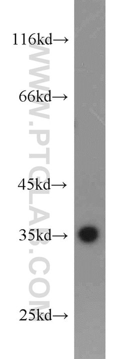 PCNA Rabbit anti-Human, Mouse, Rat, Zebrafish, Polyclonal, Proteintech