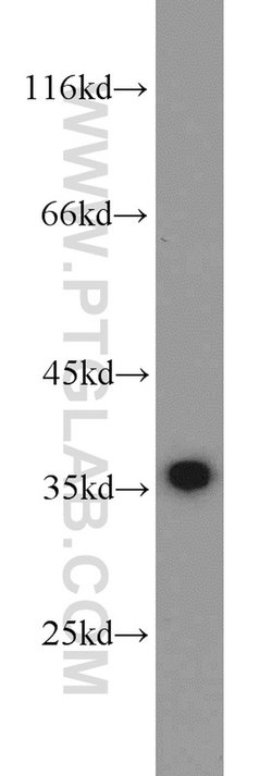 PCNA Rabbit anti-Human, Mouse, Rat, Zebrafish, Polyclonal, Proteintech
