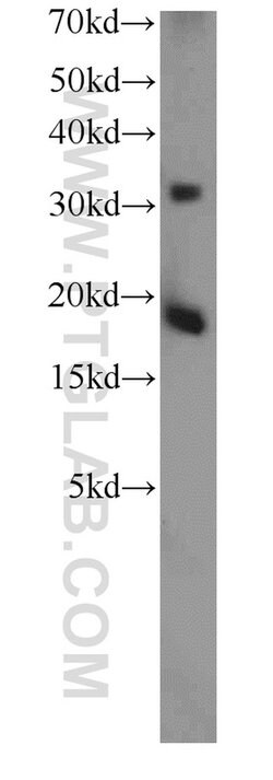 TSC22D1 Rabbit anti-Human, Mouse, Rat, Polyclonal, Proteintech:Antikörper:Primärantikörper
