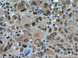 Proteintech TSC22D1 Rabbit anti-Human, Mouse, Rat, Polyclonal, Proteintech