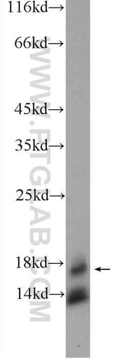 TSC22D1 Rabbit anti-Human, Mouse, Rat, Polyclonal, Proteintech:Antikörper:Primärantikörper