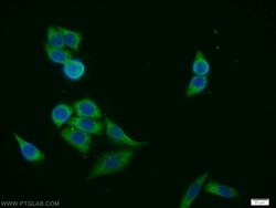 FANCG Rabbit anti-Human, Mouse, Rat, Polyclonal, Proteintech