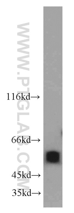 PDLIM7 Rabbit anti-Human, Polyclonal, Proteintech:Antibodies:Primary Antibodies