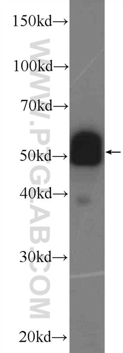 PDLIM7 Rabbit anti-Human, Polyclonal, Proteintech:Antibodies:Primary Antibodies