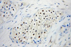 UBC9 Rabbit anti-Human, Mouse, Rat, Polyclonal, Proteintech 150 &mu;L;