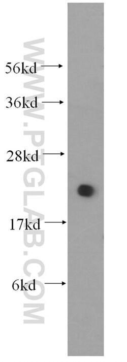 UBC9 Rabbit anti-Human, Mouse, Rat, Polyclonal, Proteintech 150 &mu;L;