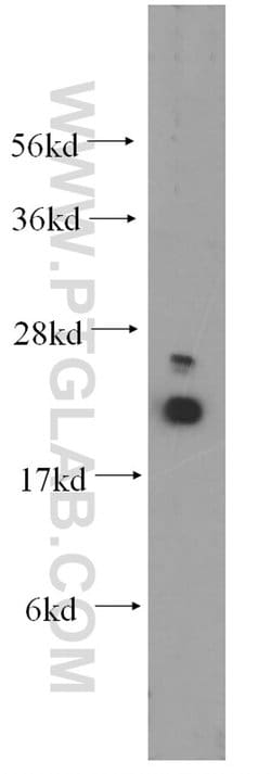 UBC9 Rabbit anti-Human, Mouse, Rat, Polyclonal, Proteintech 150 &mu;L;