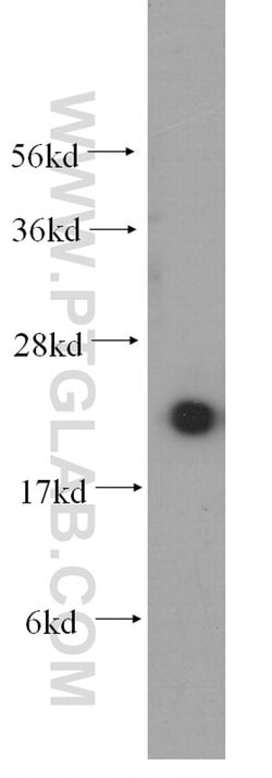 UBC9 Rabbit anti-Human, Mouse, Rat, Polyclonal, Proteintech 150 &mu;L;
