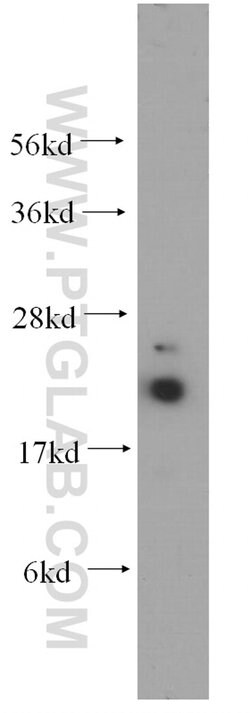 UBC9 Rabbit anti-Human, Mouse, Rat, Polyclonal, Proteintech 150 &mu;L;