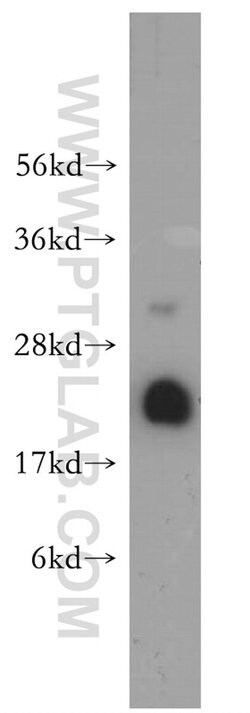 UBC9 Rabbit anti-Human, Mouse, Rat, Polyclonal, Proteintech 150 &mu;L;