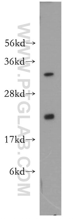 UBC9 Rabbit anti-Human, Mouse, Rat, Polyclonal, Proteintech 150 &mu;L;