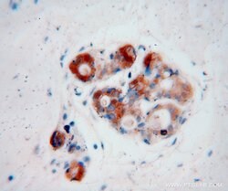 CRABP2 Rabbit anti-Human, Mouse, Rat, Polyclonal, Proteintech:Antibodies:Primary
