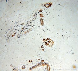 CRABP2 Rabbit anti-Human, Mouse, Rat, Polyclonal, Proteintech:Antibodies:Primary