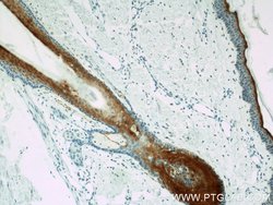 CRABP2 Rabbit anti-Human, Mouse, Rat, Polyclonal, Proteintech:Antibodies:Primary