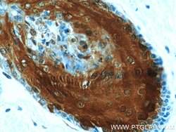 CRABP2 Rabbit anti-Human, Mouse, Rat, Polyclonal, Proteintech:Antibodies:Primary