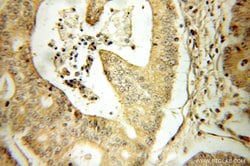 CRABP2 Rabbit anti-Human, Mouse, Rat, Polyclonal, Proteintech:Antibodies:Primary