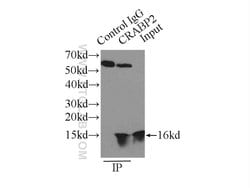 CRABP2 Rabbit anti-Human, Mouse, Rat, Polyclonal, Proteintech:Antibodies:Primary