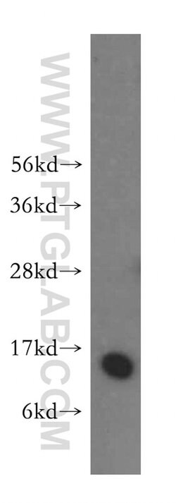 CRABP2 Rabbit anti-Human, Mouse, Rat, Polyclonal, Proteintech:Antibodies:Primary