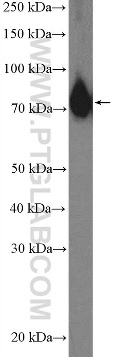 ABCF2 Rabbit anti-Human, Mouse, Polyclonal, Proteintech:Antibodies:Primary