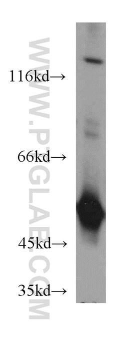 EIF2S2 Rabbit anti-Human, Mouse, Polyclonal, Proteintech 150 &mu;L; Unconjugated:Antibodies,