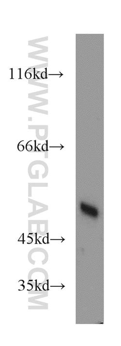 EIF2S2 Rabbit anti-Human, Mouse, Polyclonal, Proteintech 150 &mu;L; Unconjugated:Antibodies,