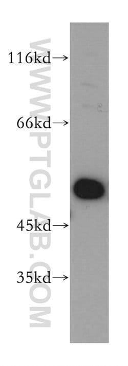 EIF2S2 Rabbit anti-Human, Mouse, Polyclonal, Proteintech 150 &mu;L; Unconjugated:Antibodies,