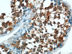 EIF2S2 Rabbit anti-Human, Mouse, Polyclonal, Proteintech 150 &mu;L; Unconjugated:Antibodies,