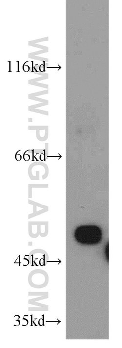EIF2S2 Rabbit anti-Human, Mouse, Polyclonal, Proteintech 150 &mu;L; Unconjugated:Antibodies,