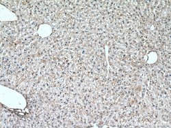 S100A11 Rabbit anti-Human, Mouse, Rat, Polyclonal, Proteintech 150 &mu;L;