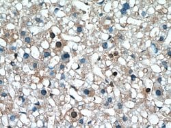 S100A11 Rabbit anti-Human, Mouse, Rat, Polyclonal, Proteintech 150 &mu;L;