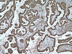 S100A11 Rabbit anti-Human, Mouse, Rat, Polyclonal, Proteintech 150 &mu;L;