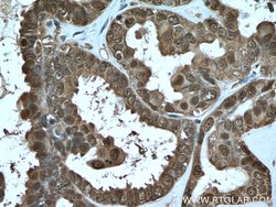 S100A11 Rabbit anti-Human, Mouse, Rat, Polyclonal, Proteintech 150 &mu;L;