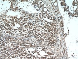 S100A11 Rabbit anti-Human, Mouse, Rat, Polyclonal, Proteintech 150 &mu;L;