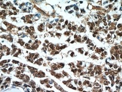 S100A11 Rabbit anti-Human, Mouse, Rat, Polyclonal, Proteintech 150 &mu;L;