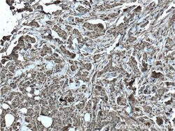 S100A11 Rabbit anti-Human, Mouse, Rat, Polyclonal, Proteintech 150 &mu;L;
