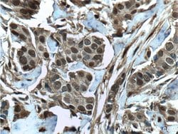 S100A11 Rabbit anti-Human, Mouse, Rat, Polyclonal, Proteintech 150 &mu;L;