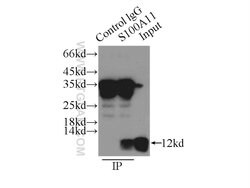 S100A11 Rabbit anti-Human, Mouse, Rat, Polyclonal, Proteintech 150 &mu;L;